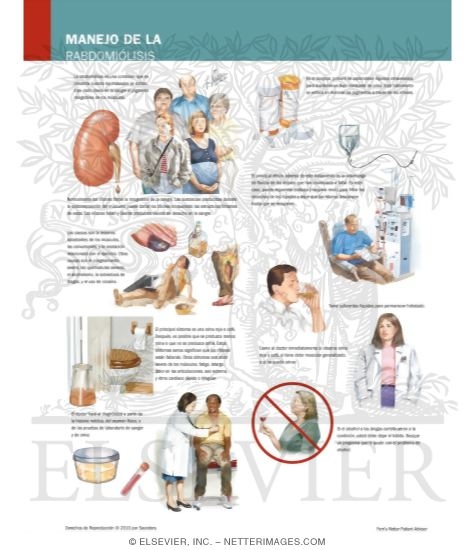 Watermarked preview of labeled image: Managing Your Rhabdomyolysis