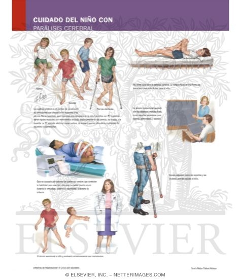 Managing Your Cerebral Palsy