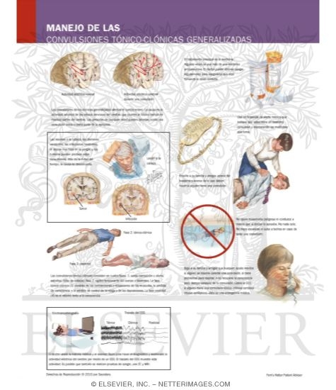 Managing Your Generalized Tonic-Clonic Seizures