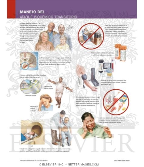 Watermarked preview of labeled image: Managing Your Transient Ischemic Attack
