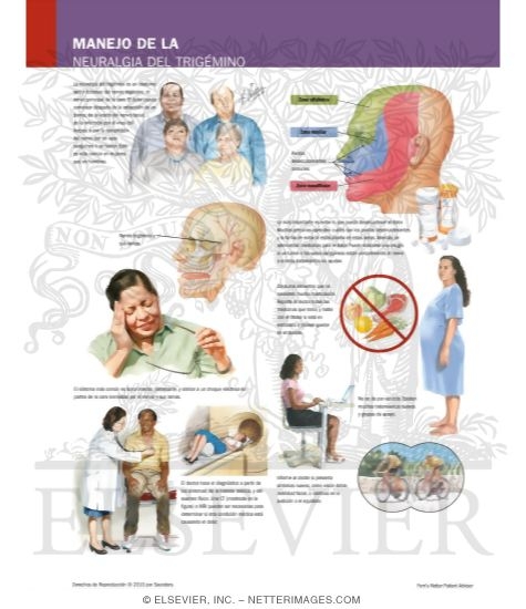 Managing Your Trigeminal Neuralgia