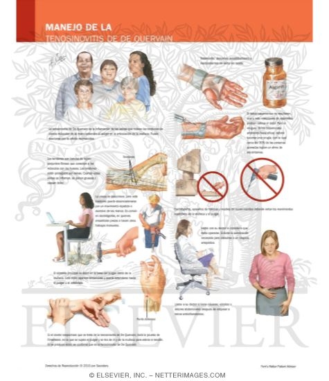 Watermarked preview of labeled image: Managing Your DeQuervain's Tenosynovitis