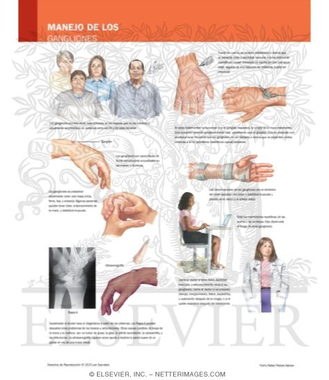 Watermarked preview of labeled image: Managing Your Ganglia