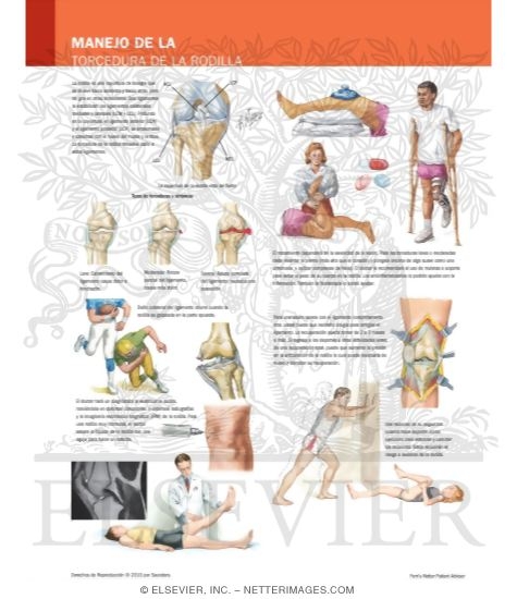 Manejo de la Torcedura de la Rodilla
