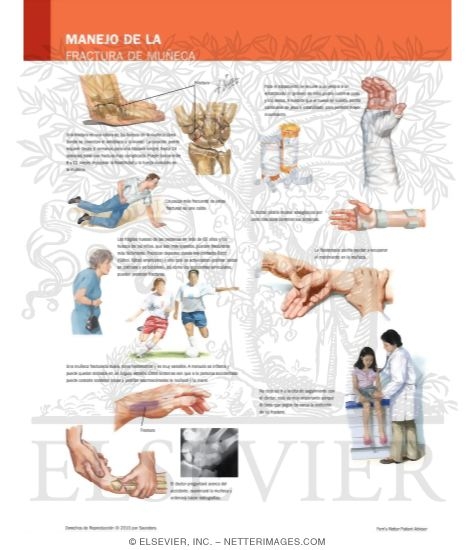 Managing Your Wrist Fracture