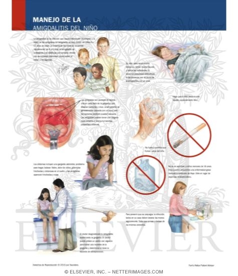 Watermarked preview of labeled image: Caring for Your Child With Tonsillitis
