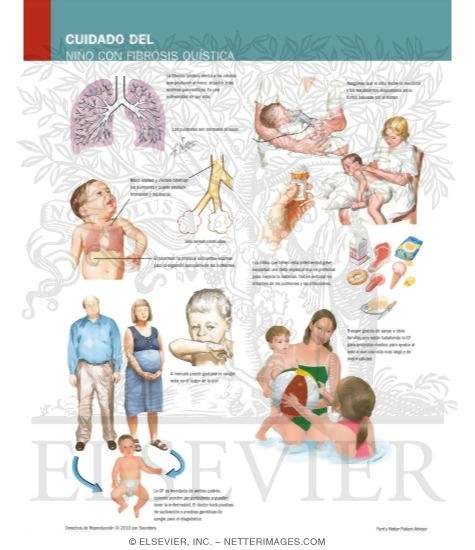 Caring for Your Child With Cystic Fibrosis