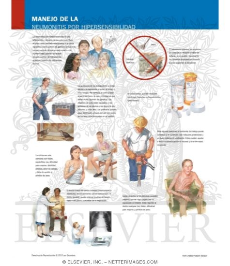 Watermarked preview of labeled image: Managing Your Hypersensitivity Pneumonitis