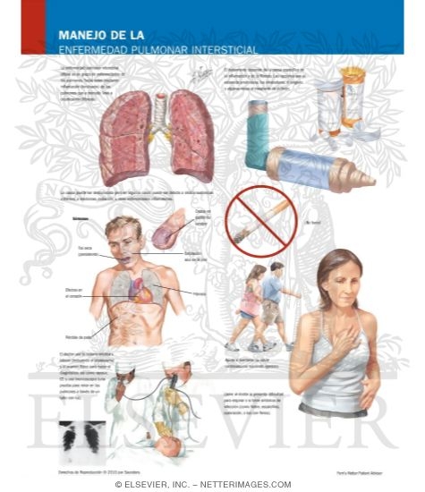 Managing Your Interstitial Pulmonary Disease