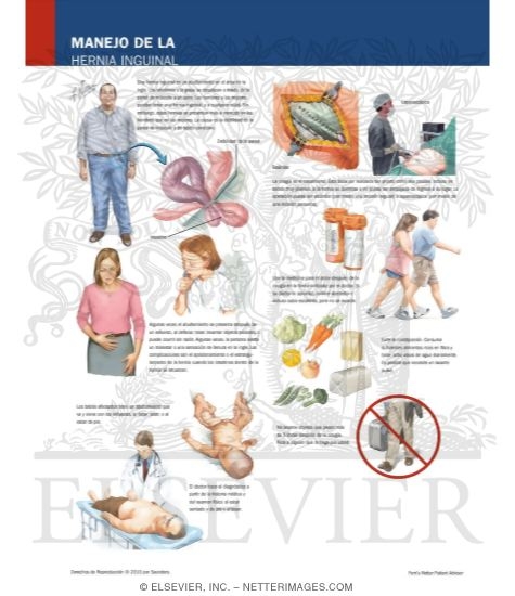 Watermarked preview of labeled image: Managing Your Inguinal Hernia