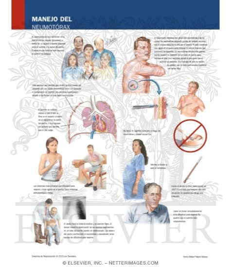 Watermarked preview of labeled image: Managing Your Pneumothorax
