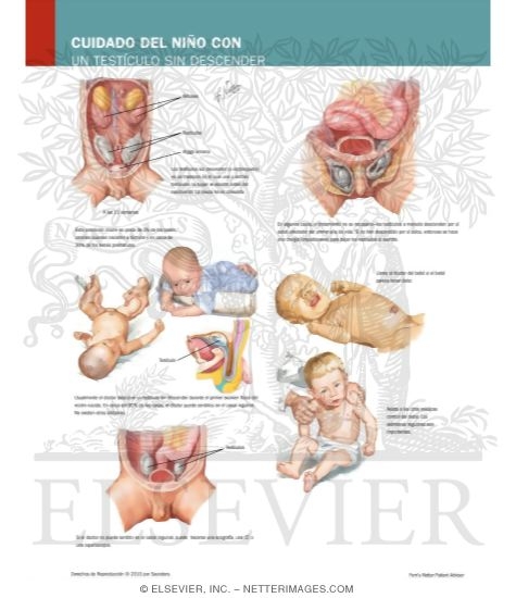 Caring for Your Child Born With An Undescended Testicle