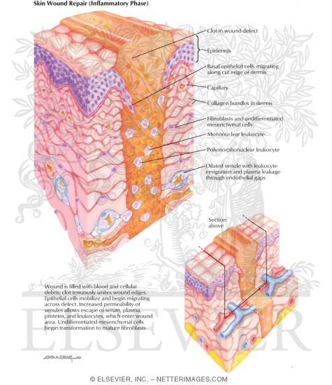 Watermarked preview of labeled image: Skin Wound Repair