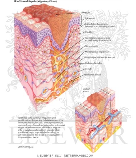 Watermarked preview of labeled image: Skin Wound Repair