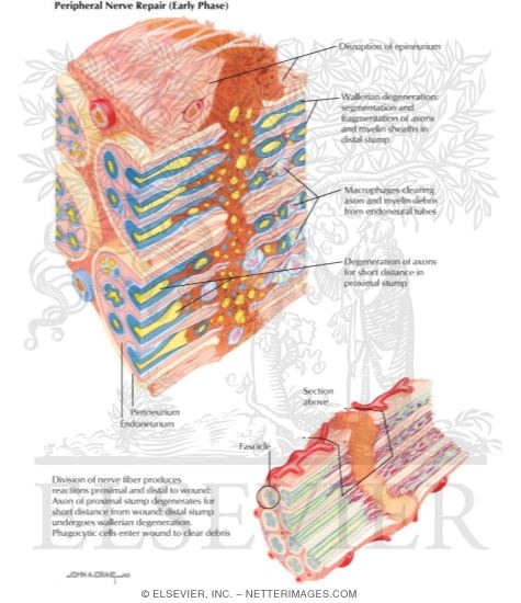 Watermarked preview of labeled image: Peripheral Nerve Repair
