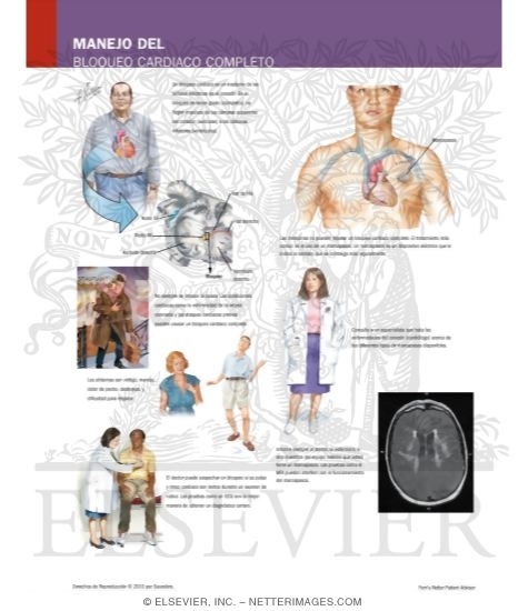 Watermarked preview of labeled image: Managing Your Complete Heart Block