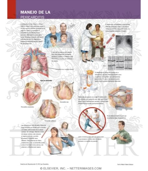 Watermarked preview of labeled image: Managing Your Pericarditis