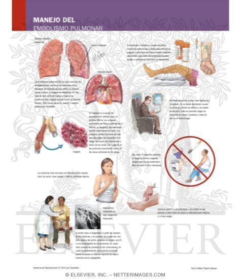 Watermarked preview of labeled image: Managing Your Pulmonary Embolism