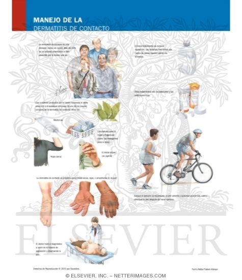 Watermarked preview of labeled image: Managing Your Contact Dermatitis