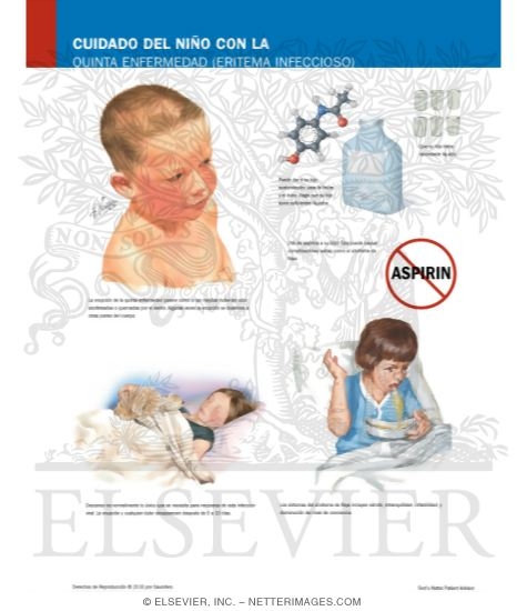 Watermarked preview of labeled image: Caring for Your Child With Fifth Disease