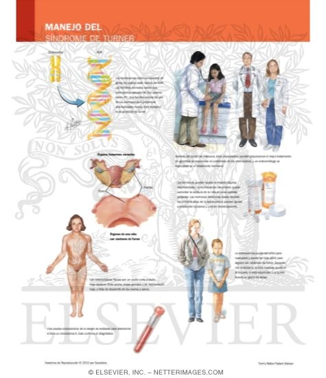 Watermarked preview of labeled image: Caring for Your Child With Turner's Syndrome