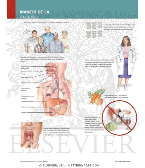 Watermarked preview of labeled image: Managing Your Halitosis