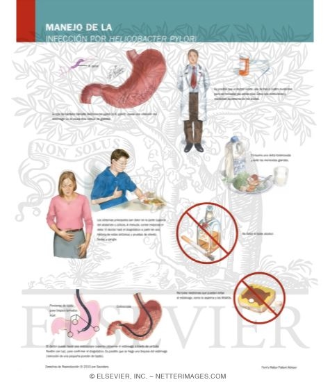 Managing Your Helicobacter Pylori Infection