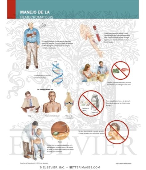 Manejo de la Hemocromatosis