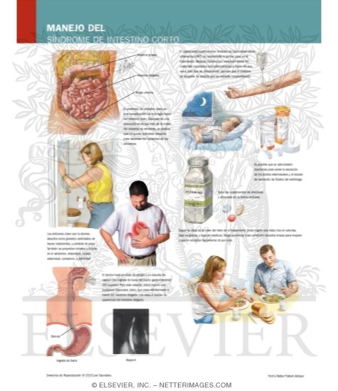 Watermarked preview of labeled image: Managing Your Short Bowel Syndrome