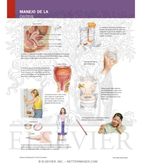 Watermarked preview of labeled image: Managing Your Cystitis