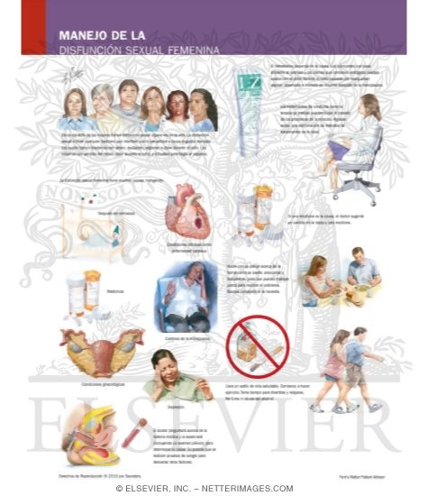 Watermarked preview of labeled image: Managing Your Female Sexual Dysfunction
