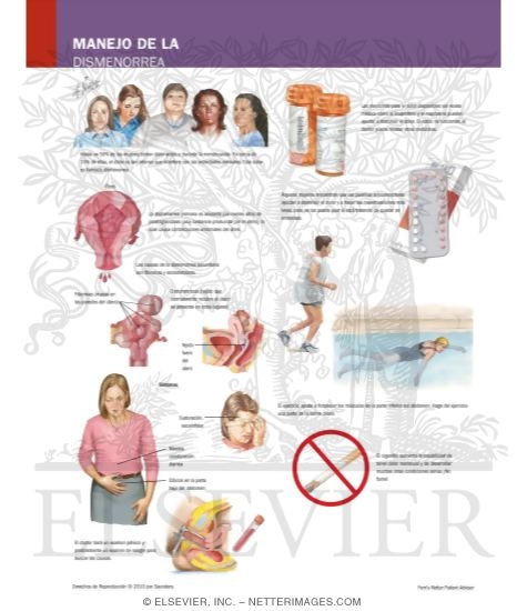 Watermarked preview of labeled image: Managing Your Dysmenorrhea