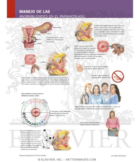 Understanding Your Pap Smear Abnormalities