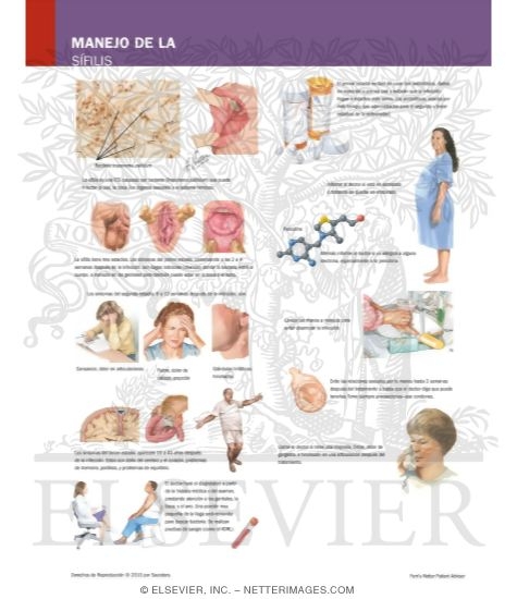 Watermarked preview of labeled image: Managing Your Syphilis