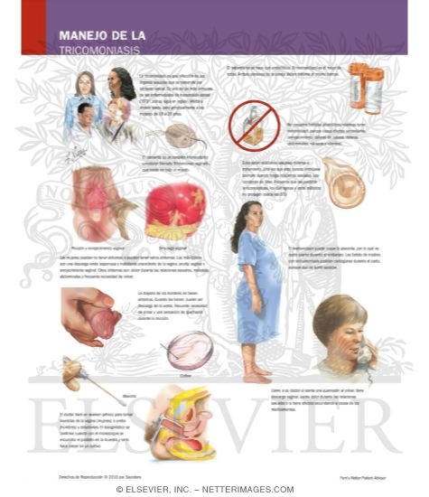 Managing Your Trichomoniasis
