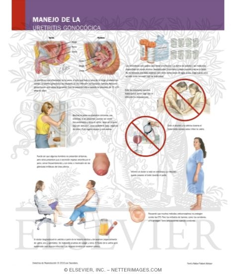 Managing Your Gonococcal Urethritis