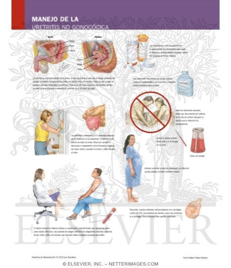 Watermarked preview of labeled image: Managing Your Nongonococcal Urethritis