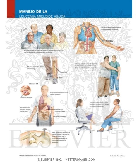 Watermarked preview of labeled image: Managing Your Acute Myelogenous Leukemia