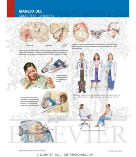 Watermarked preview of labeled image: Managing Your Brain Cancer