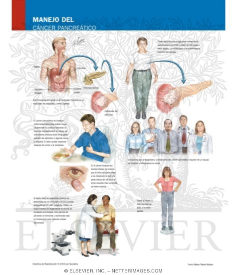 Managing Your Pancreatic Cancer