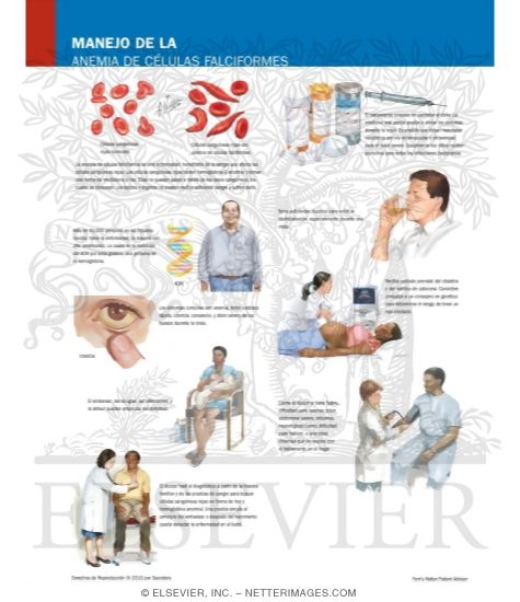 Watermarked preview of labeled image: Managing Your Sickle Cell Anemia