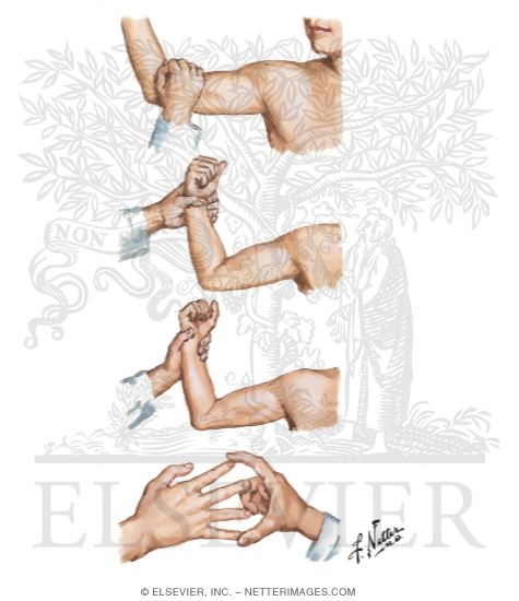 Manual Muscle Testing of the Upper Limb