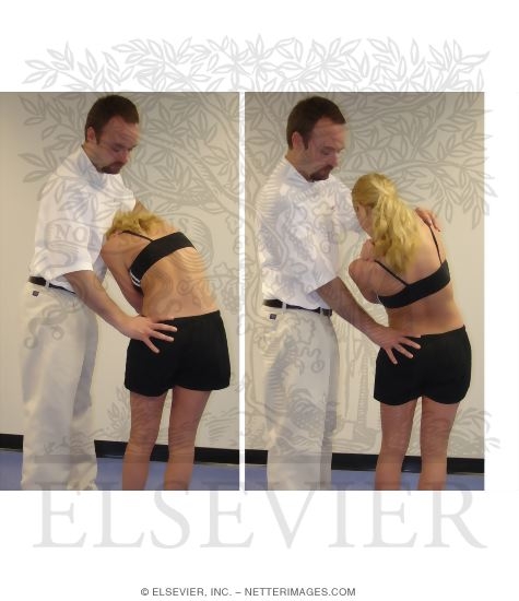 Pain Provocation During Active Movements