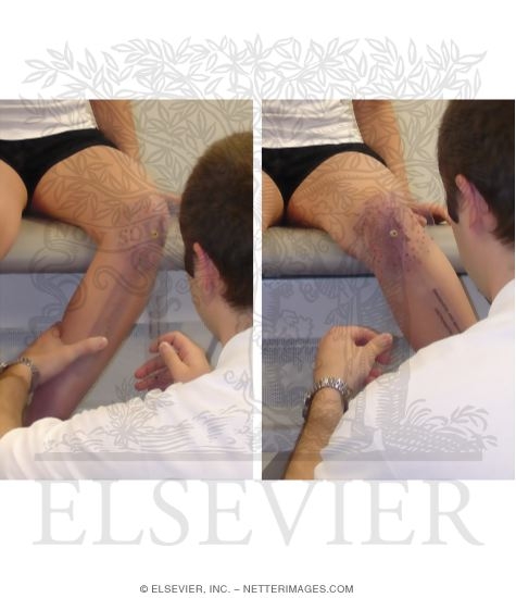 Watermarked preview of unlabeled image: Measurement of Passive Range of Motion