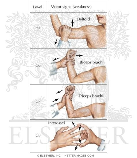 Manual Muscle Testing of the Upper Limb