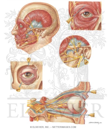 Watermarked preview of unlabeled image: Cataracts Akinesia and Anesthesia