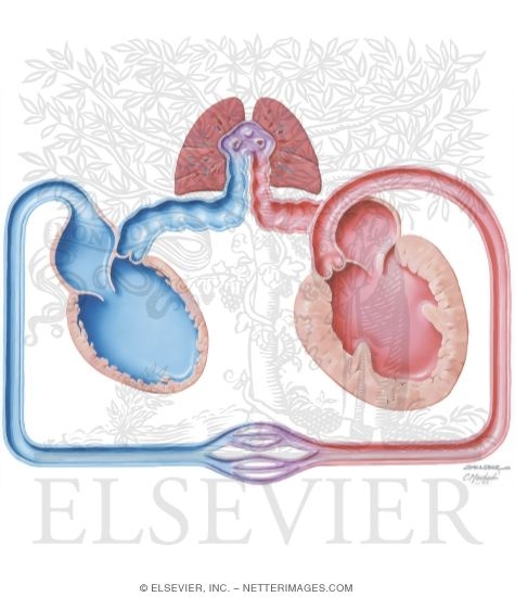 Watermarked preview of unlabeled image: Congestive Heart Failure; Schematic #2