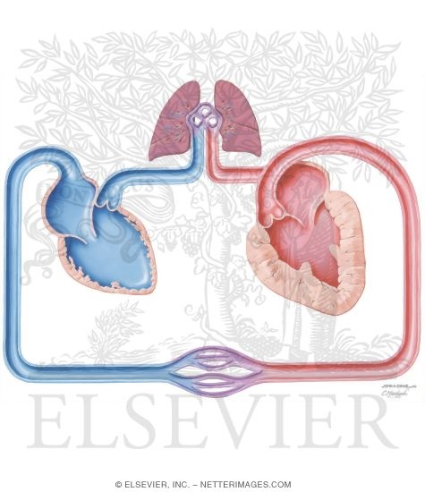 Watermarked preview of unlabeled image: Congestive Heart Failure; Schematic #5
