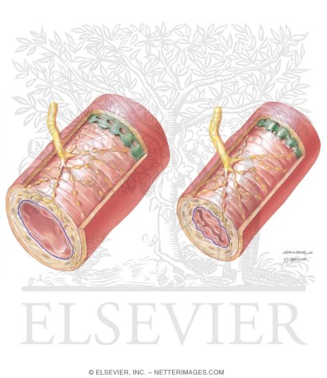 Watermarked preview of unlabeled image: Vascular Smooth Muscle Contraction