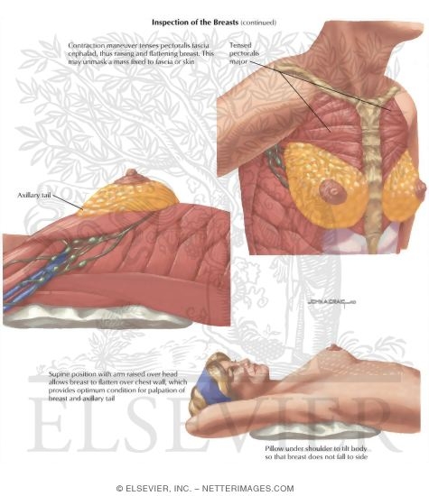 Positions for Examination of the Breast